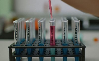 Jak poprawic dostęp do badan laboratoryjnych i skrocic proces leczenia